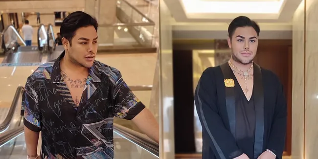 Hidung Makin Mancung Dan Bibir Kian Tebal, Potret Ivan Gunawan yang Kini Bikin Pangling, Netizen: Masih Ganteng Dulu