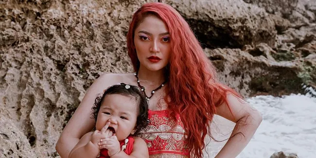 Idap Tumor Kelenjar Getah Bening, Siti Badriah Kesulitan Gendong Anak Hingga Tak Bisa Angkat Lengannya Sendiri