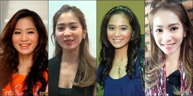 Ini Bukti Perubahan Drastis Wajah Bunga Zainal, Dituding Oplas!