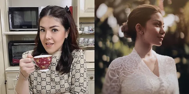 Penampilan Berubah dan Semakin Cantik, 8 Selebriti Ini Justru Digosipkan Lakukan Operasi Plastik - Ada Cita Citata Hingga Tina Toon