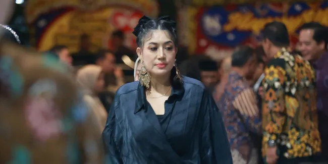 Penyanyi Sania Pilih Operasi Breast Reduction, Terungkap Alasannya