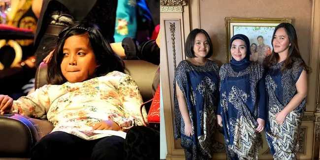 Pernah Diculik dan Nyaris Ditebus Rp4 Miliar Saat Kelas 5 SD, Ini 10 Potret Nana Putri Muzdalifah Sekarang - Tumbuh Jadi Gadis Cantik