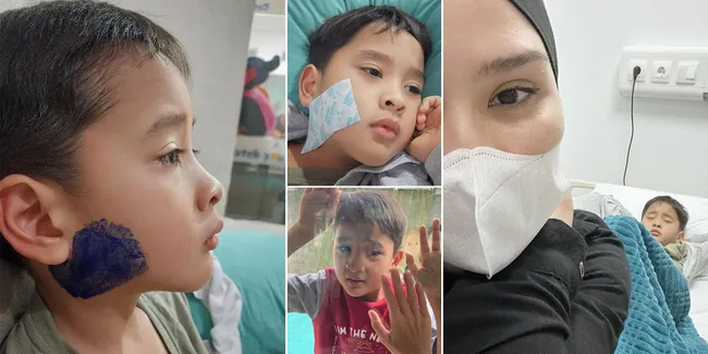 Potret Bhai Kaba Putra Zaskia Adya Mecca Terkena Penyakit Gondongan Usai Tertular Teman Satu Kelas di Sekolah