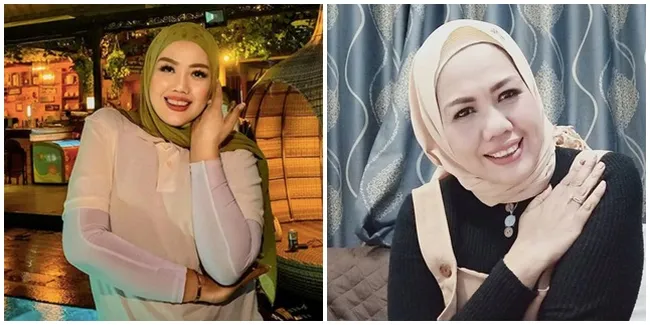 Potret Elly Sugigi yang Kerap Dapatkan Bullyan dari Netizen, Disebut Tak Bisa Ciuman Karena Bentuk Gigi