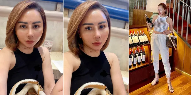 Potret Terbaru Femmy Permatasari Usai Oplas Hidung di Korea, Wajahnya Sudah Terlihat Beda - Netizen Sebut Mirip Denise Chariesta