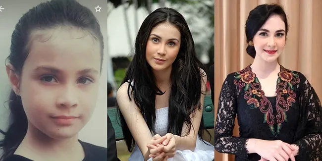 Potret Transformasi Arumi Bachsin Dari Dulu Sampai Kini Jadi Ibu Wagub, Masa Kecilnya Mirip Banget Sama Lakeisha 