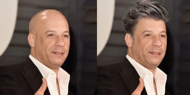 Seleb Berikut, Lebih Baik Gundul Atau Berambut?