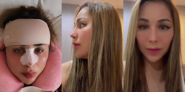 Sempat Dikira Wanita Tulen, 8 Potret Transgender Gebby Vesta Perdana Oplas Wajah di Usia 36 Tahun - Dipuji Makin Cantik Pasca Rombak Hidung dan Dahi