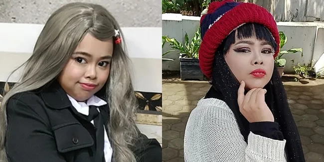 Sempat Disebut Mirip Babi, Ini 7 Potret Terbaru Kekeyi Usai Filler Hidung - Makin Glow Up dan Banjir Pujian