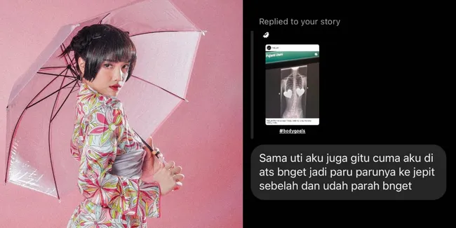 Sering Disebut Body Goals, 8 Potret Fuji Ungkap Idap Penyakit Skoliosis - Tulang Belakang Miring