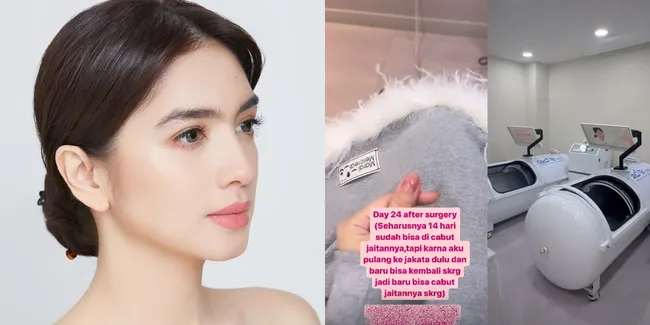 Sudah Cantik Paripurna, Potret Angel Karamoy Lakukan Operasi Plastik di Korea - Masih Rahasiakan Hasilnya