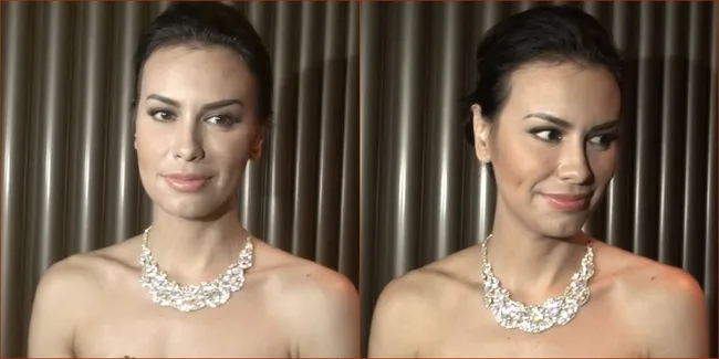 Usai Operasi Punggung, Sophia Mueller Makin 'Berani' nan Seksi