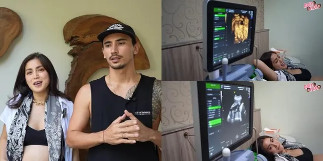 Usia Kehamilan Terungkap, 8 Momen Jessica Iskandar Jalani USG Pertama - Wajah Buah Hati Mirip Vincent Verhaag