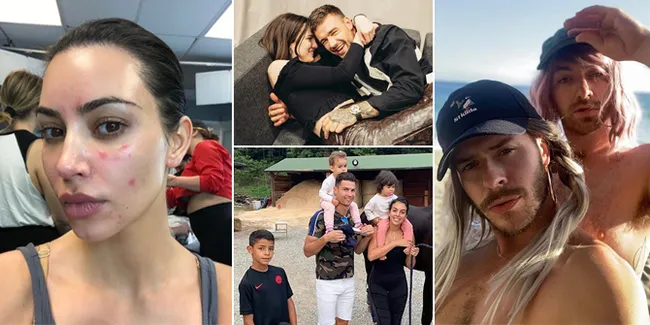 Weekly Hot IG: Sam Smith Pakai Wig Pink - Psoriasis di Wajah Kim Kardashian