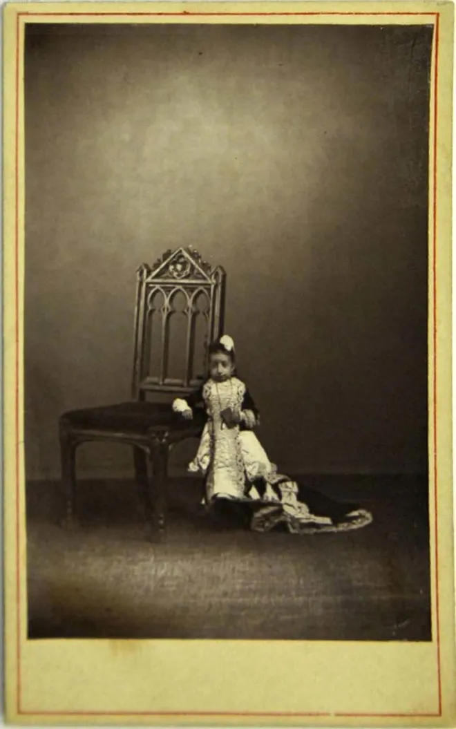 FOTO: Sirkus Manusia Aneh Zaman Dulu Ini Bikin Spontan ...