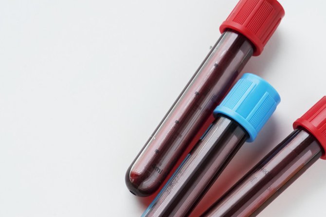 8 Penyebab Darah Kental Yang Perlu Diketahui Beserta Cara Mencegahnya 7647