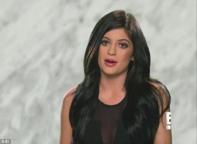 terkuak! bibir sensual kylie jenner ternyata hasil lip injection