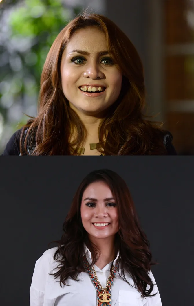 kisah momo geisha rapikan giginya, sampai dicaci warganet!