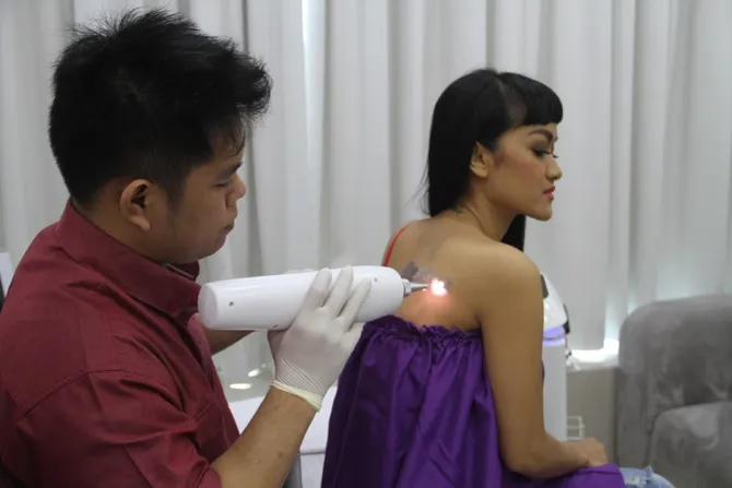 hapus tato, langkah move on jupe dari gaston castano