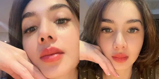 2 Bulan Setelah Oplas, Begini Potret Terbaru Angel Karamoy