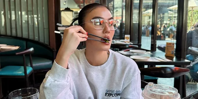 Agnez Mo Berjuang Melawan Alopecia Areata, Gejalanya Bercak Botak Akibat Stres