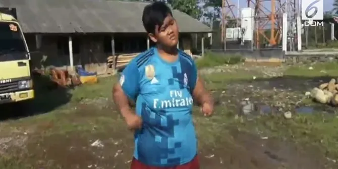 Arya Permana Bocah Obesitas Asal Karawang Kini Berhasil Turun 83 Kg