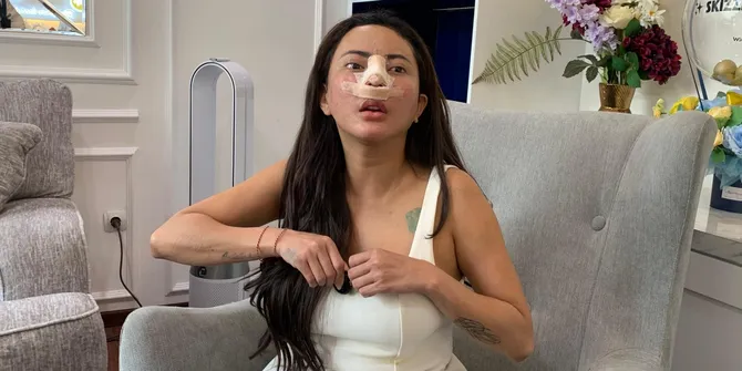 Ayu Aulia Habiskan 100 Juta Untuk Operasi Hidung Demi Film Horor
