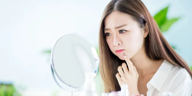 Bekas Jerawat Susah Hilang? Ternyata Ini Penyebab & Cara Ampuh Mengatasinya