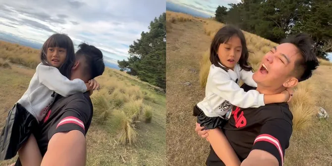 Boy William Kena Ulti Keponakan, Disebut Punya Hidung Palsu