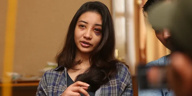 Dengan Wajah Berlumuran Darah, Saori Ishii Minta Bantuan Security