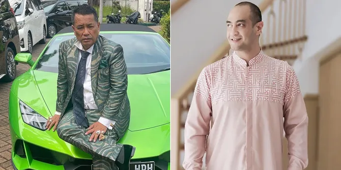 Dengar Kabar Ferry Irawan Pakai Jasa Hotma Sitompul, Hotman Paris: Mereka Cocok