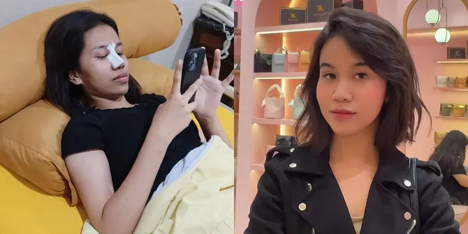 Diduga Lakukan Operasi Hidung, Ini Penampakan Terbaru Mayang Adik Mendiang Vanessa Angel