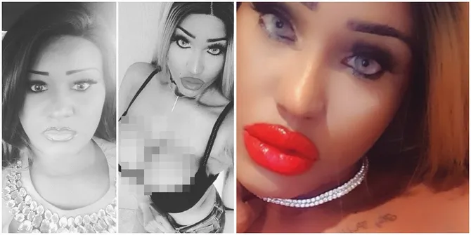 Diselingkuhi Tunangan, Seorang Wanita Nekad Oplas Mirip Sex Doll