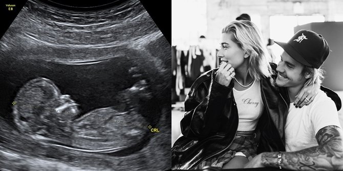 Justin Bieber Unggah Foto Hasil Usg Hailey Baldwin Hamil