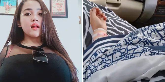 Nggak Tahan Dibully Netizen, Clara Gopa Duo Semangka Nekat Lakukan Percobaan Bunuh Diri