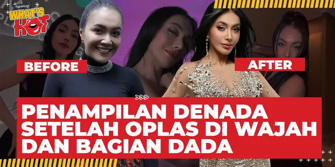 Penampilan Baru Denada Setelah Oplas Wajah dan Bagian Dada, Terlihat Muda - Keriput Hilang