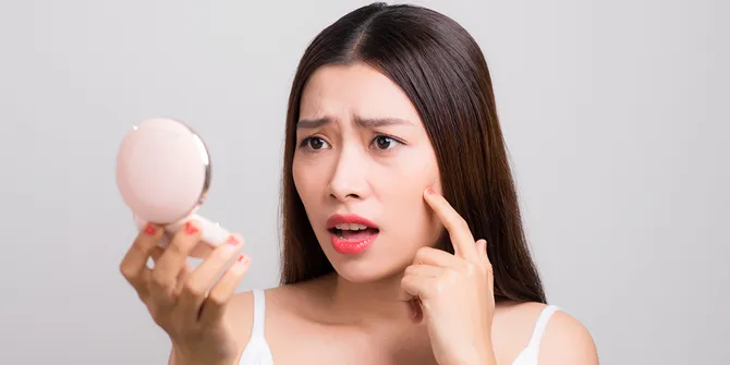 PIE vs PIH, Jangan Ketukar! Ini Cara Biar Bekas Jerawat Cepat Memudar