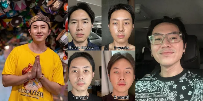 Rafael Tan Lakukan Tiga Tindakan Operasi Sekaligus di Korea Selatan, Ini Alasannya