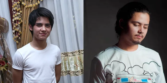 Sempat Menghilang dari Layar Kaca, Ini Potret Dulu vs Kini Aliando Syarief yang Sempat Jadi Sorotan karena Derita OCD