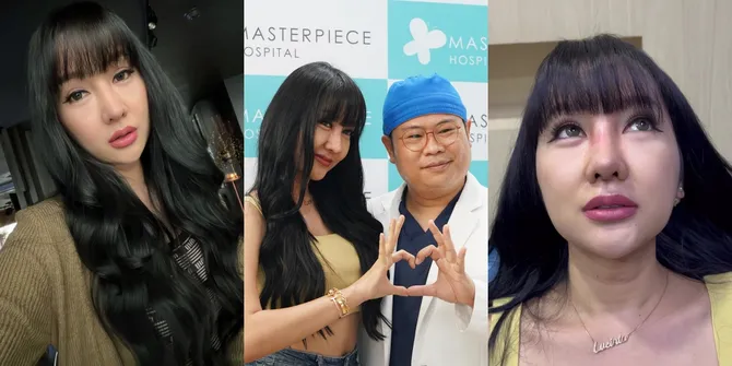 10 Potret Lucinta Luna Pamer Hidung Baru Seharga 400 Juta, Masih Bengkak Sudah Dicibir Netizen Aneh - Lebih Cantik Sebelum Oplas