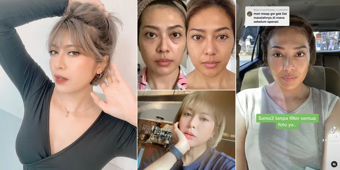 10 Potret Transformasi Yenny AFI yang Jujur Akui Oplas Hidung, Makin Cantik & Glow Up Banget
