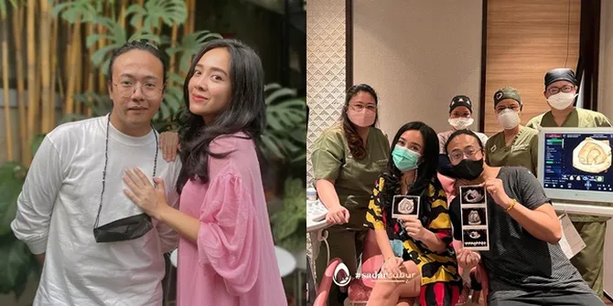 12 Tahun Menanti, 9 Potret Terbaru Dea Ananda Makin Cantik dan Glowing yang Hamil Anak Pertama