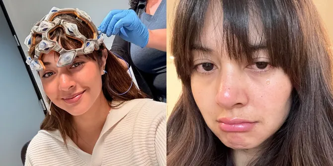 7 Potret Aurelie Moeremans Ungkap Cobaan Pernikahan Setelah Gegar Otak Kecelakaan, Dampaknya Menguras Emosional