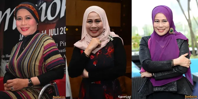 7 Potret Dewi Yull Ungkap Kronologi Mata Buta Sebelah, Alami Ablasi Retina karena Mata Minus Tinggi
