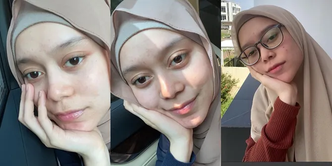 8 Potret Lesti Kejora Tanpa Makeup, Bukti Cantiknya Natural Setiap Waktu