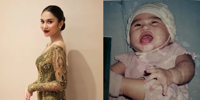 8 Potret Masa Kecil Azizah Salsha, Bikin Netizen Gemas Maksimal!