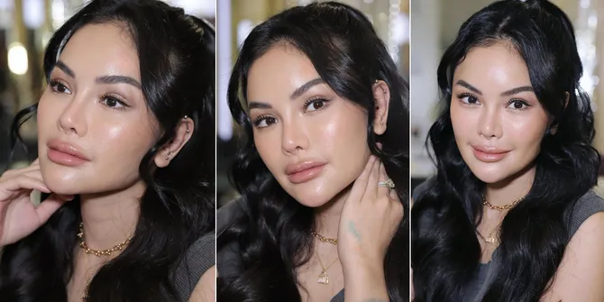 8 Potret Wajah Baru Nikita Mirzani Usai Oplas di Korea, Disebut Makin Cantik Hingga Mirip Nindy Ayunda