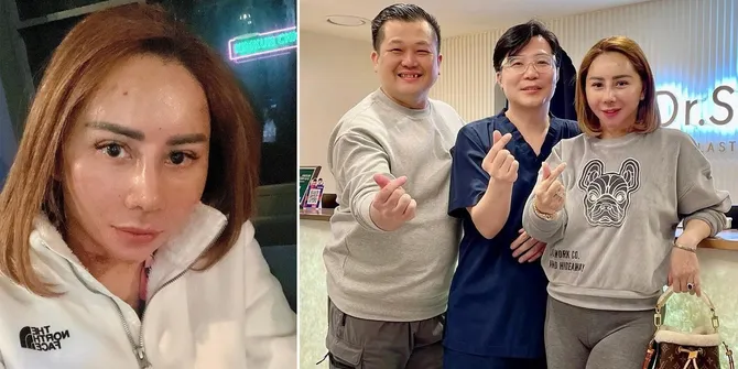 Akhirnya Lepas Masker, Intip Wajah Baru Femmy Permatasari Setelah Oplas Hidung dan Face Lift di Korea
