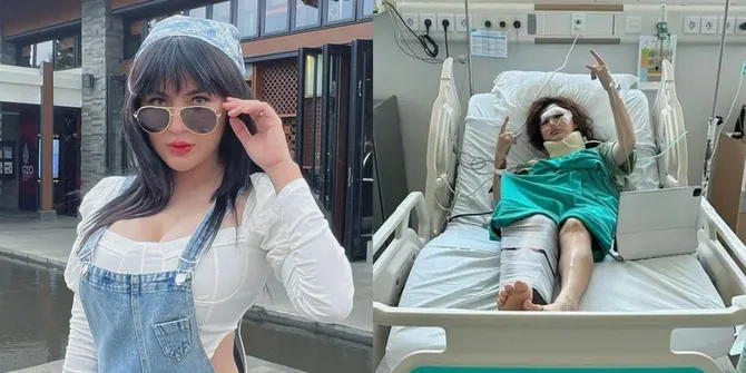 Alami Kecelakaan di Tol, Potret Kondisi Terkini Angela Lee di Rumah Sakit - Kaki Dipasang Gips dan Wajah Bengkak