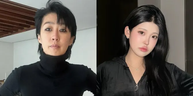 Anak Hong Jin Kyung Dituding Oplas, Sang Ibu Bongkar Fakta Sebenarnya